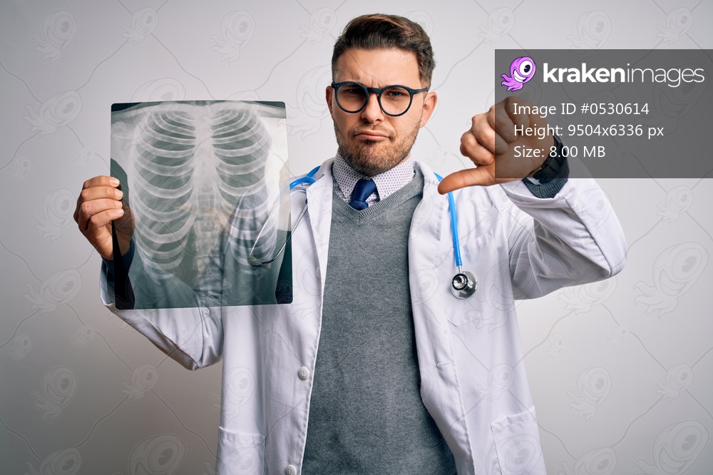 Young doctor man wearing medical coat looking at chest scan radiography over isolated background with angry face, negative sign showing dislike with thumbs down, rejection concept