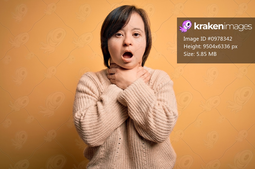 Young down syndrome woman wearing casual sweater over yellow background shouting and suffocate because painful strangle. Health problem. Asphyxiate and suicide concept.